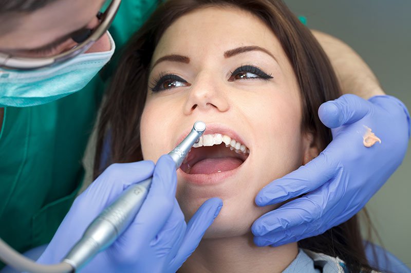 Dental-Cleaning