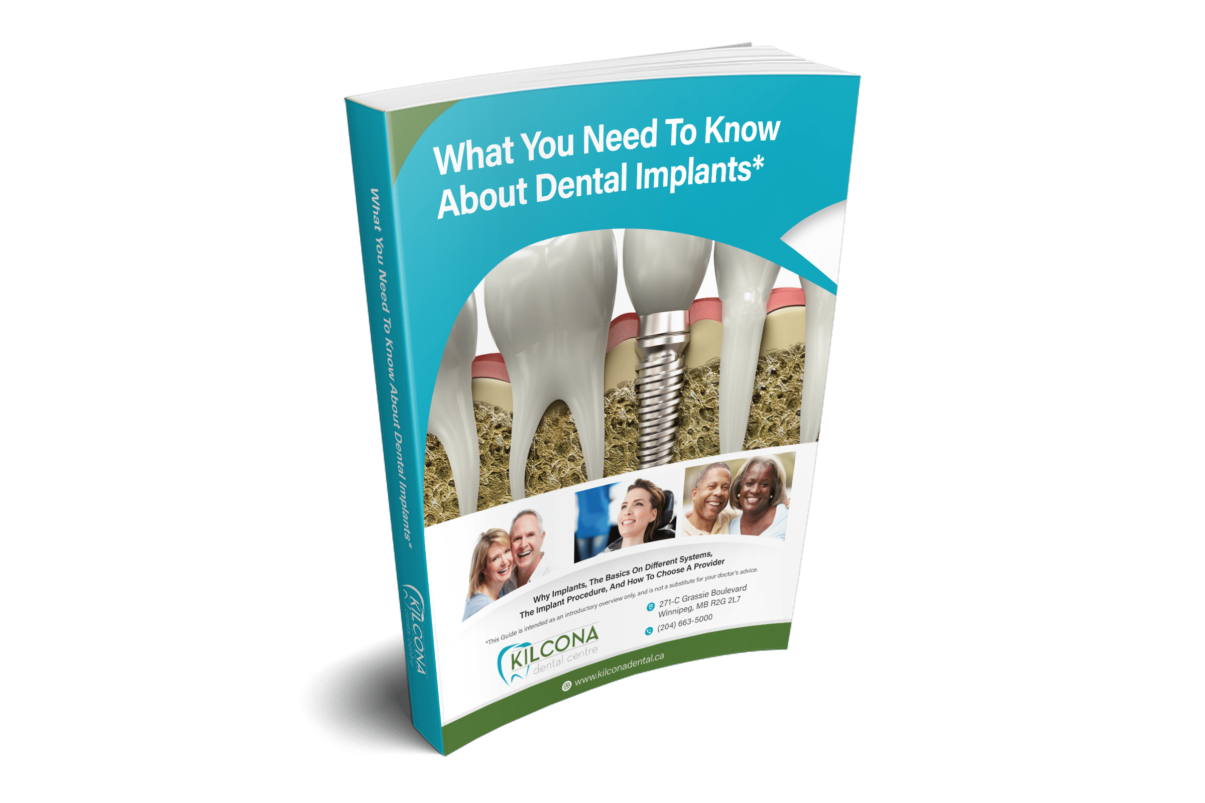 What You Need To Know About Dental Implants